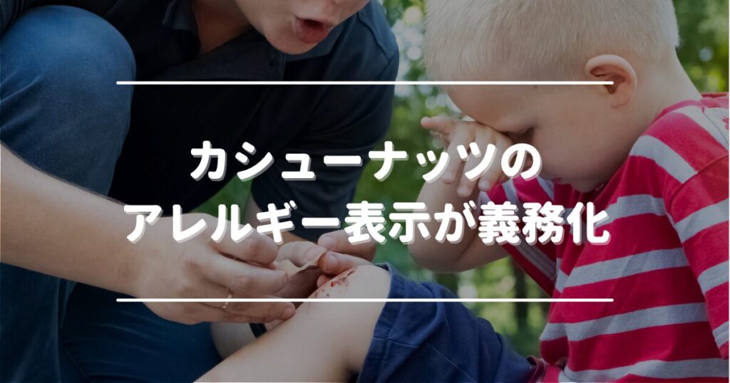 Mandatory allergy labeling for cashew nuts