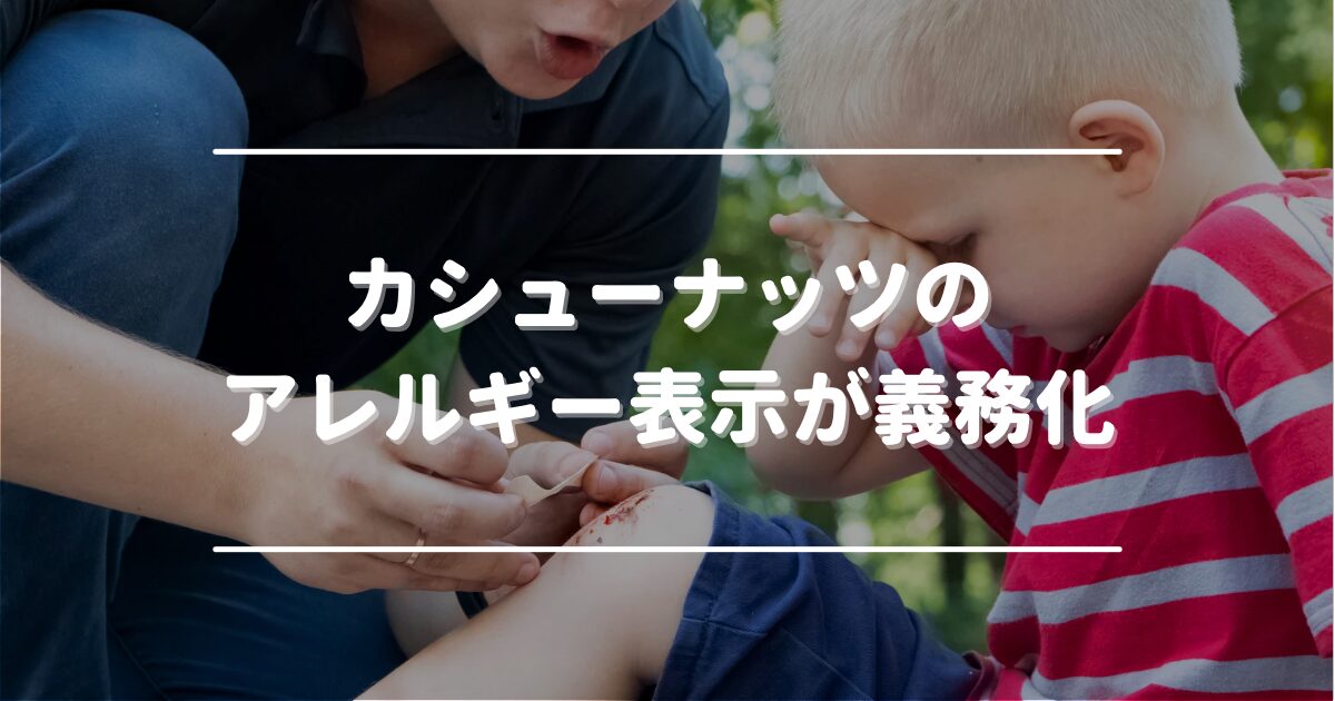 Mandatory allergy labeling for cashew nuts